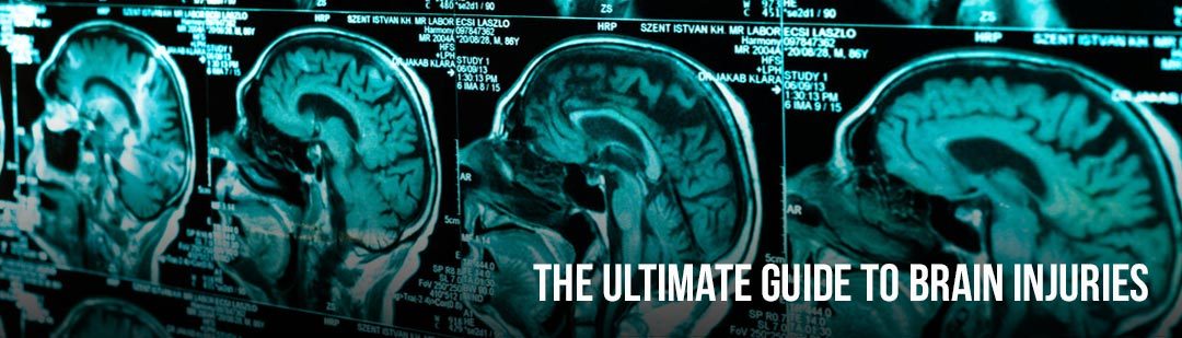 The Ultimate Guide To Brain Injuries