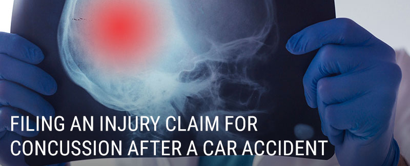 Filing an Injury Claim for Concussion